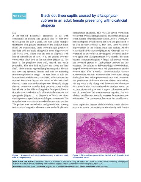 (PDF) Black dot tinea capitis caused by trichophyton rubrum in an adult female presenting with ...