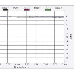 Platelet aggregation test by LTA at the time diagnosis. (a) Platelet... | Download Scientific ...