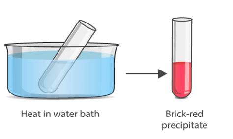 Benedict’s Test: Objectives, Principle, Procedure, Results, Limitations ...