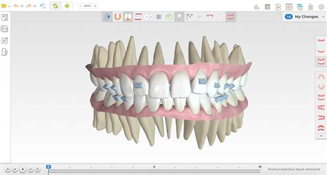 Spark™ Clear Aligners - Maryland Advanced Orthodontics | Gaithersburg MD