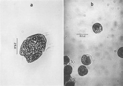 Gymnodinium splendens. (a) Normal cell, (b) abnormal cells | Download ...