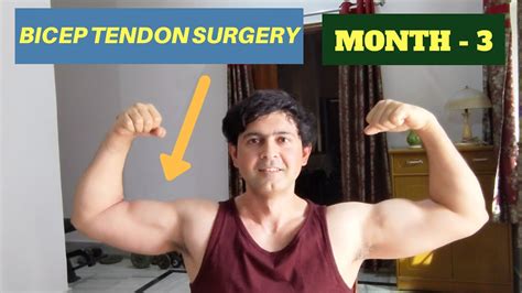 Distal Bicep Tendon Repair || Recovery Month - 3 - YouTube