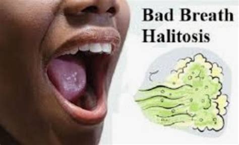 HALITOSIS