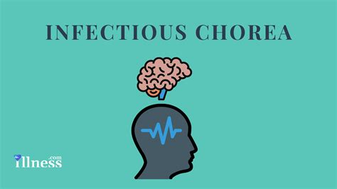 Sydenham Chorea : Overview, Causes, Symptoms, Treatment - illness.com