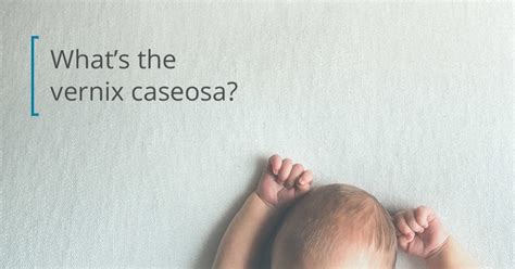 Vernix Caseosa: Benefits for Baby