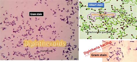 Diphtheria bacillus versus Diphtheroids: Introduction and differences in