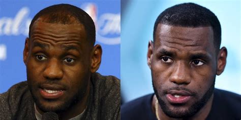 LeBron James also had a hair transplant (VIDEO)