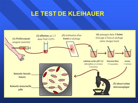 test de kleihauer