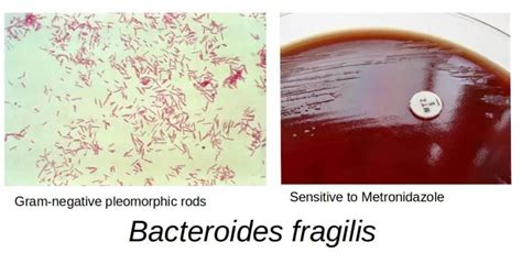 Bacteroides fragilis: Properties, Pathogenesis, Lab Diagnosis • Microbe ...