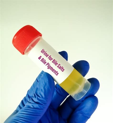 Premium Photo | Urine sample for bile salts and bile pigments test