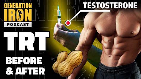 Before & After Using TRT: Pros & Cons Of Testosterone Replacement Therapy | GI Podcast - YouTube