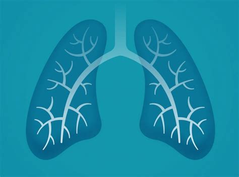 Lung Hyperinflation: A Complication of Breathing Disorders - Facty Health