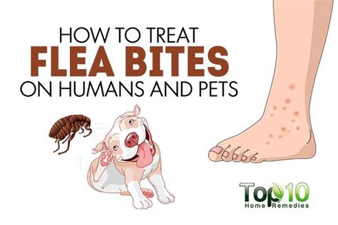 How to Treat Flea Bites on Humans and Pets | Top 10 Home Remedies