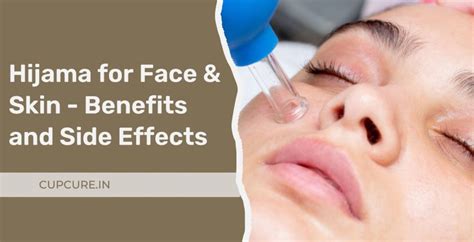 Hijama for Face & Skin - Benefits and Side Effects - CupCure