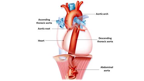 The Aorta & TAAD — Genetic Aortic Disorders Association Canada