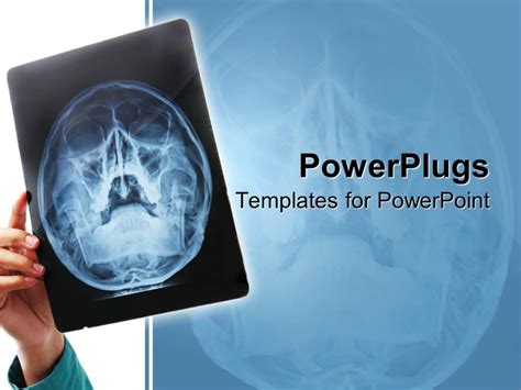 Radiology Powerpoint Templates X Ray Powerpoint Template Mandegar Inside Radiology Powerpoint ...