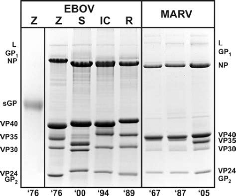 Filoviridae: Marburg and Ebola Viruses | Basicmedical Key