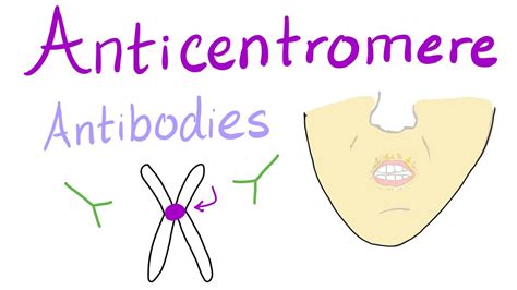 Anticentromere Antibodies - YouTube