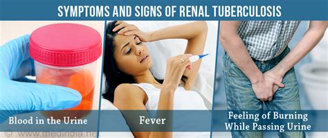 Renal Tuberculosis - Causes, Symptoms, Complications, Diagnosis & Treatment