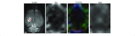 | (a) T2-weighted image. (b) Fractional anisotropy map. (c) Color... | Download Scientific Diagram