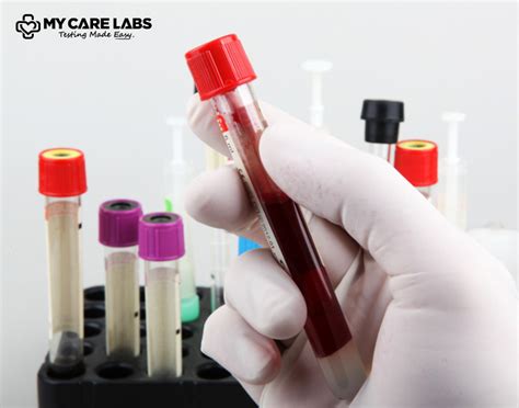 Liver Function Panel Blood Test for Comprehensive Assessment - My Care Labs