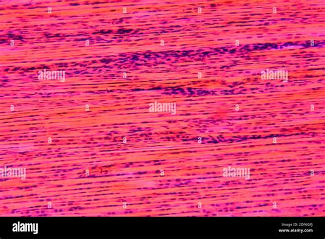 Connective tissue with collagen fibers hi-res stock photography and images - Alamy