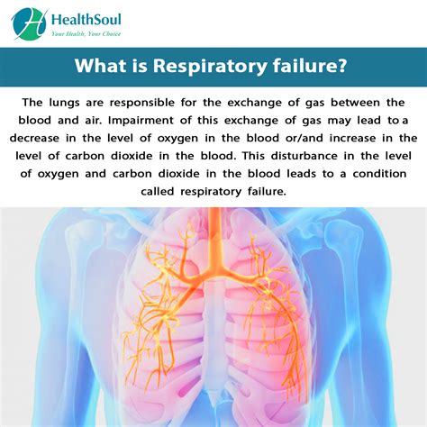 Respiratory Failure