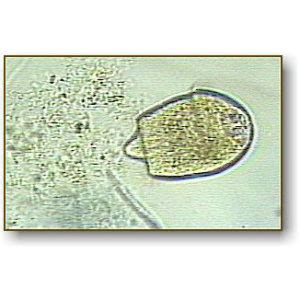 Didinium | Microbus Microscope Educational Website