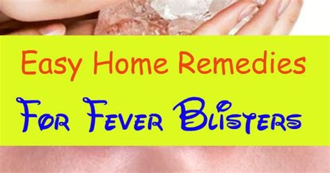 26 Easy Home Remedies for Fever Blisters | Tips | Pinterest | Home, Home remedies and Remedies