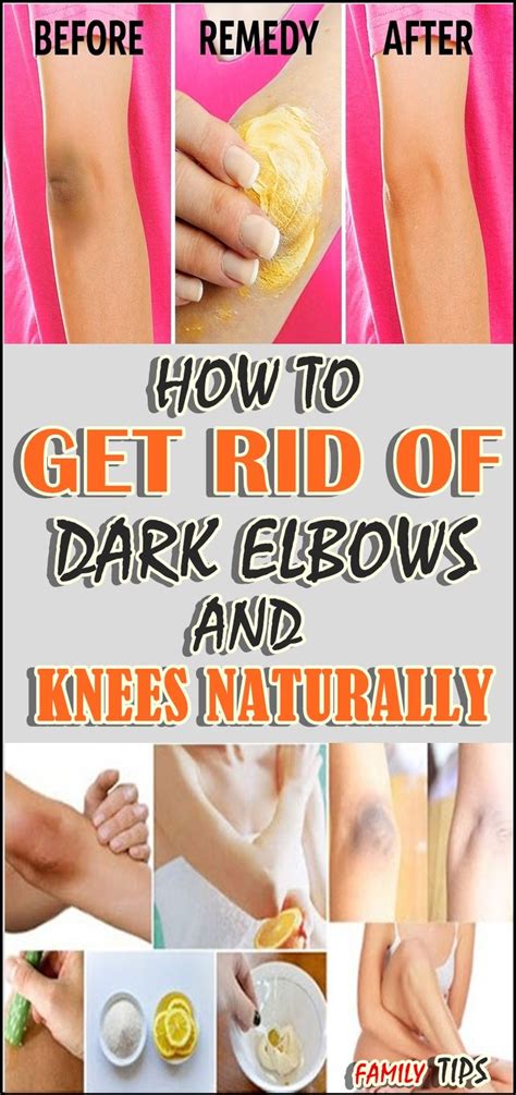 Get Rid Of Saggy Elbow Skin With These Tips | Justinboey