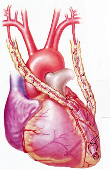 Coronary Artery Bypass Surgery - Cardiology Specialists