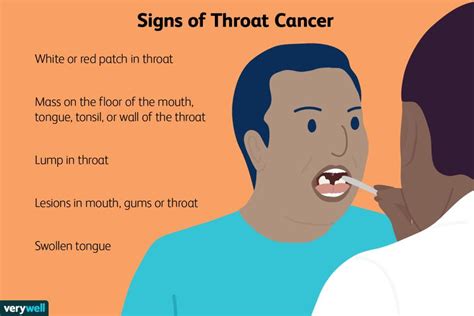 Throat Cancer Pictures: Signs, Symptoms, and Causes