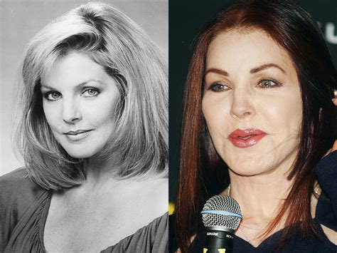 Priscilla Presley - Celebrity Plastic Surgery Disasters? - CBS News