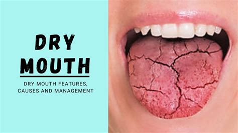 Causes Of Dry Mouth And Lips | Lipstutorial.org