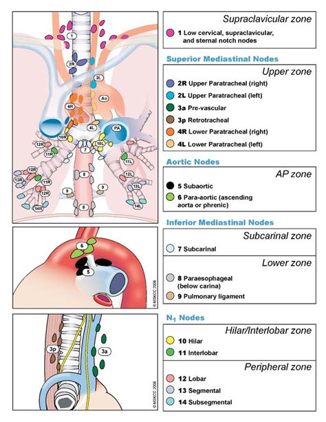 Esophageal Cancer Staging Tnm