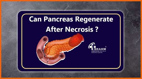 Pancreatic Necrosis | Pancreatic Necrosis Treatment | Pancreatic Necrosis Treatment In Homeopathy