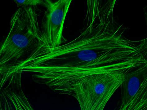 Difference Between Actin and Myosin | Compare the Difference Between Similar Terms