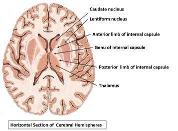 Internal capsule - The internal capsule is a white matter structure ...