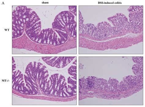 Colon Vs Small Intestine Histology / Thoc1 gene deletion affects the histology of the small ...