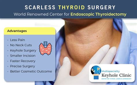 Thyroid Surgery | - Keyhole Clinic Thiruvananthapuram