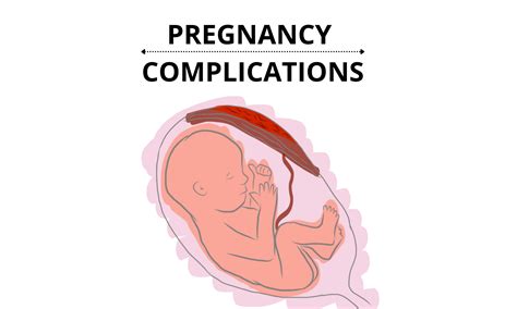 Pregnancy Complications: When Things Go Wrong - Pro doctor