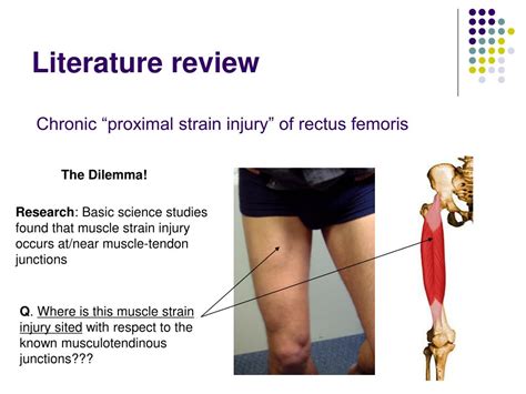 PPT - Acute Quadriceps Muscle Strains MRI features and prognosis ...