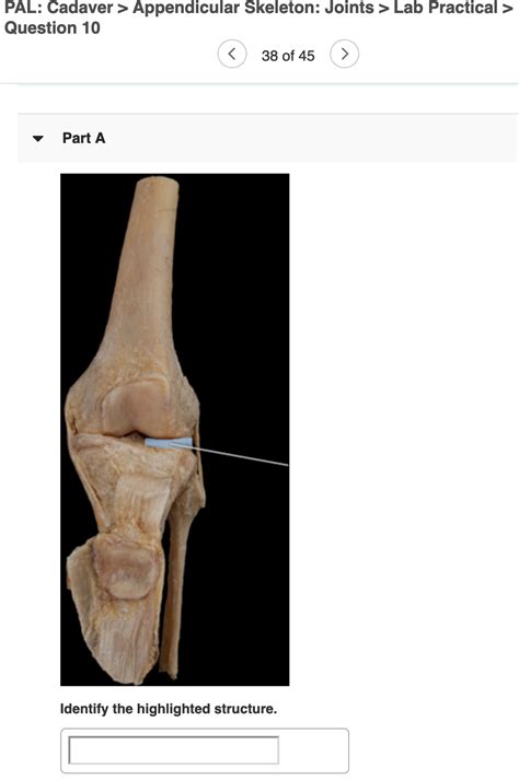 Solved: PAL: Cadaver > Appendicular Skeleton: Joints > Lab... | Chegg.com