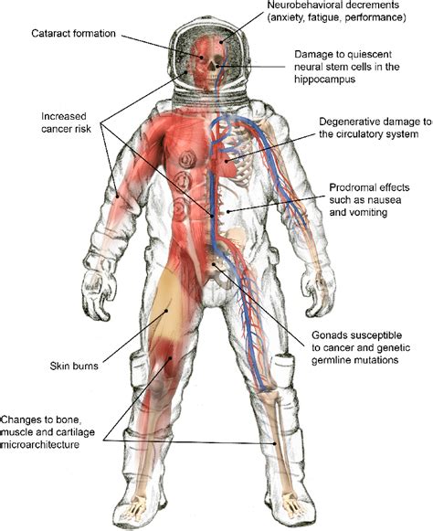 Mutations In Humans Caused By Radiation