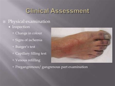 Chronic lower limb ischemia