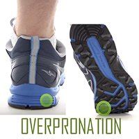 Pronation, Overpronation, Underpronation, Foot Types, Choosing Your Shoes