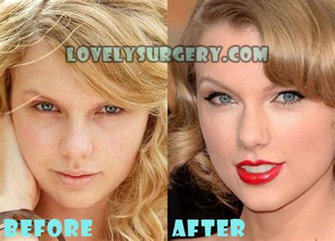 Taylor Swift Plastic Surgery Nose Job, Boob Job Before After - Lovely Surgery