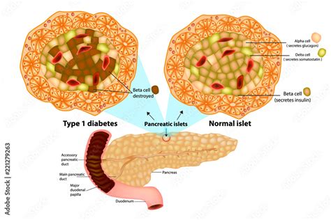 The pancreas has many islets that contain insulin-producing beta cells ...