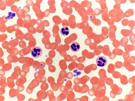 Blood smear, LM - Stock Image - C050/0510 - Science Photo Library