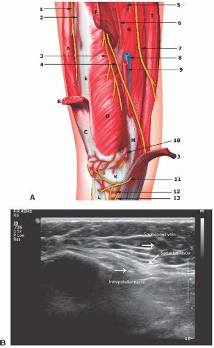 Ultrasound-Guided Saphenous Nerve Block of the Thigh, Knee, and Ankle | Anesthesia Key